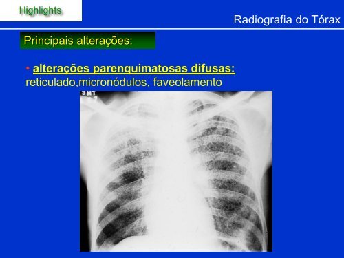 Métodos de Diagnóstico por Imagem aplicados ao Tórax