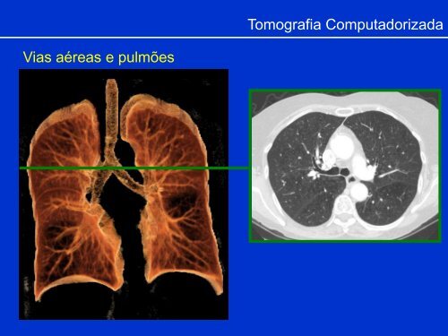 Métodos de Diagnóstico por Imagem aplicados ao Tórax