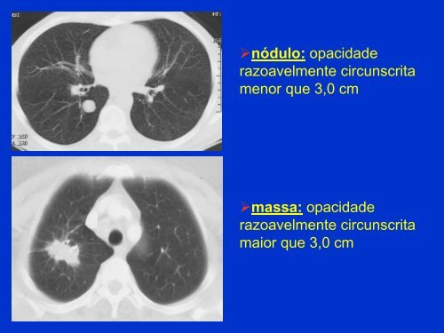 Métodos de Diagnóstico por Imagem aplicados ao Tórax