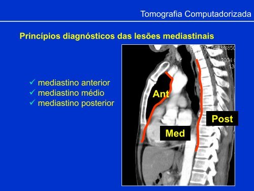 Métodos de Diagnóstico por Imagem aplicados ao Tórax