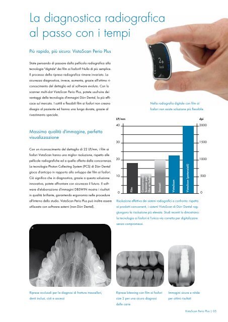 VistaScan Perio Plus scanner per film ai fosfori â piÃ¹ ... - Dental Trey