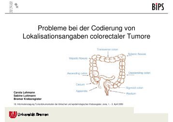 Probleme bei der Codierung von Lokalisationsangaben colorectaler ...