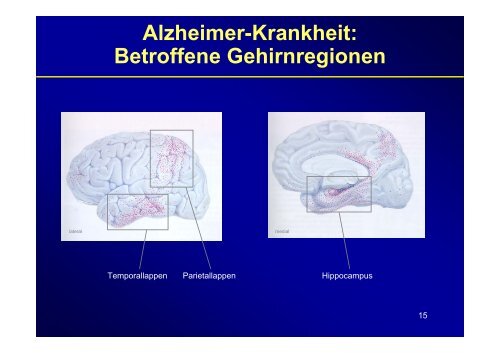 Therapie & Differentialdiagnose der Demenz