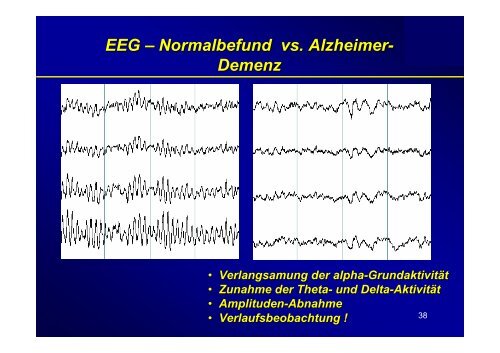 Therapie & Differentialdiagnose der Demenz