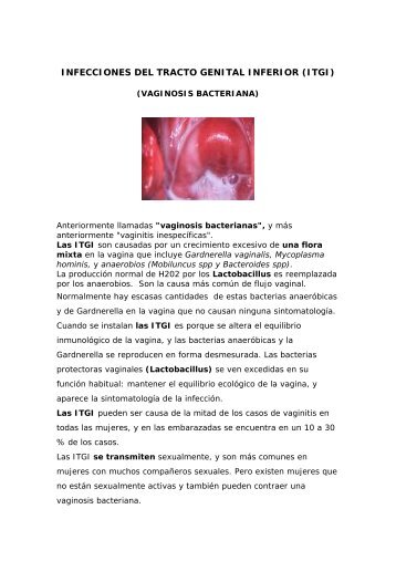INFECCIONES DEL TRACTO GENITAL INFERIOR (ITGI)