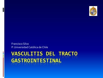 Vasculitis del tracto gastrointestinal