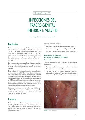 infecciones del tracto genital inferior i: vulvitis - Univadis