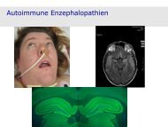 Autoimmune Enzephalopathien