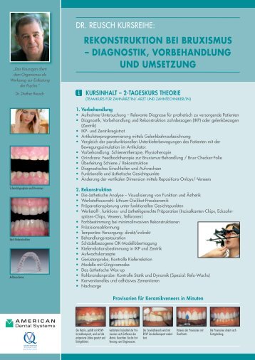 REKONSTRUKTION BEI BRUXISMUS ... - American Dental Systems