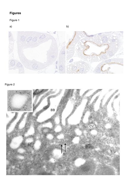 Mutually-dependent localization of megalin and ... - Renal Physiology