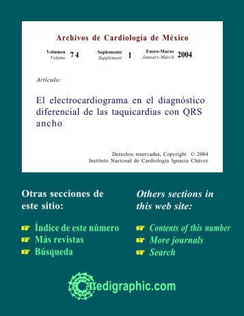 El electrocardiograma en el diagnóstico diferencial ... - edigraphic.com