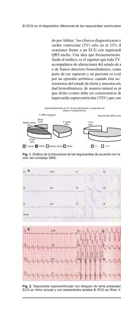 El electrocardiograma en el diagnóstico diferencial ... - edigraphic.com