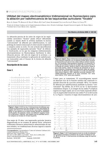 Dr. Hugo Garro y colaboradores - electrofisiologia.org.ar