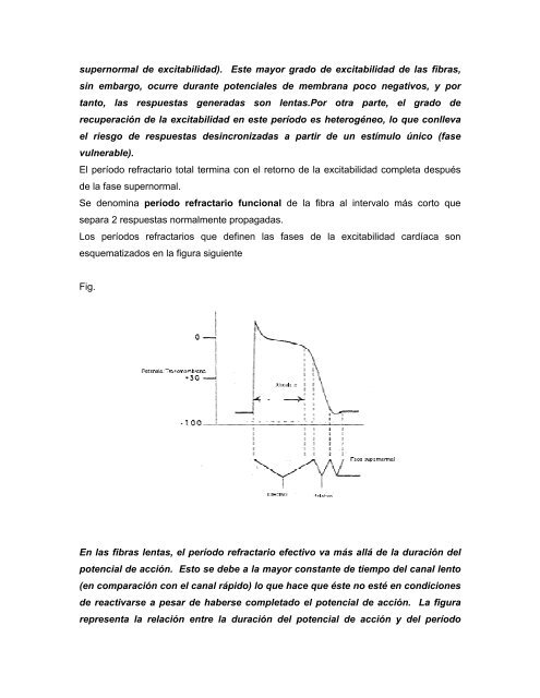 Arritmias