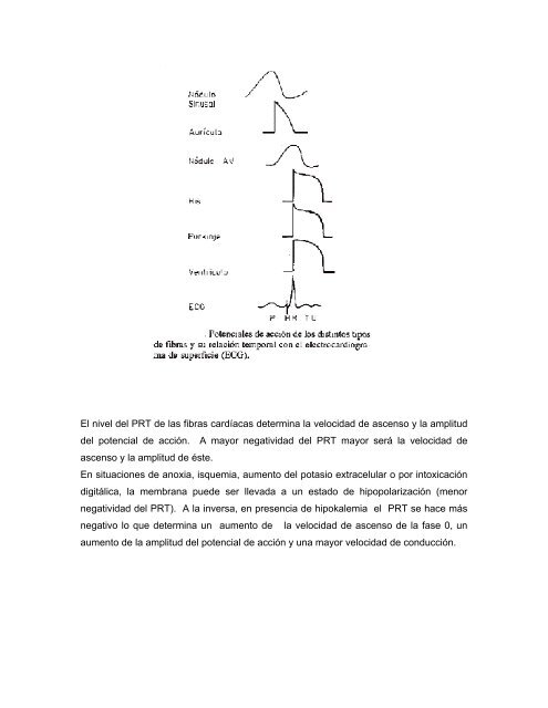 Arritmias