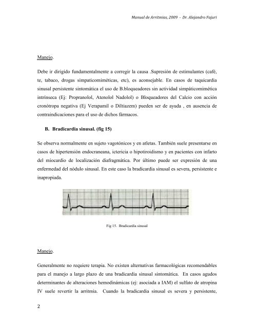 Taquicardia sinusal e hipertensión Taquicardia sinusal e hipertensión