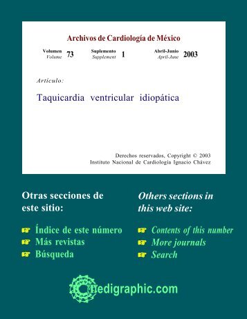 Taquicardia ventricular idiopática - edigraphic.com