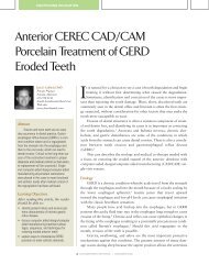 Anterior CEREC CAD/CAM Porcelain - Eureka Smile Center