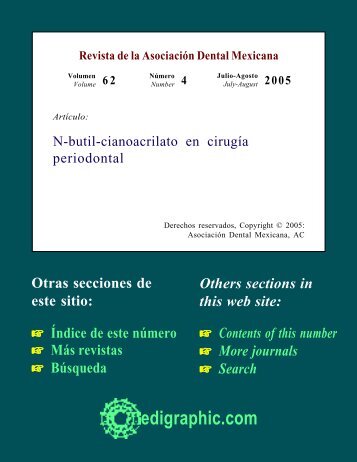 N-butil-cianoacrilato en cirugía periodontal - edigraphic.com