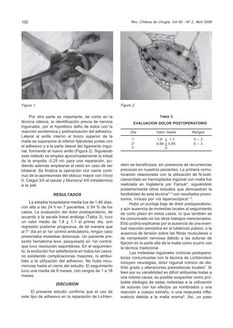 Hernioplastia inguinal con malla sin tensión. Experiencia ... - SciELO