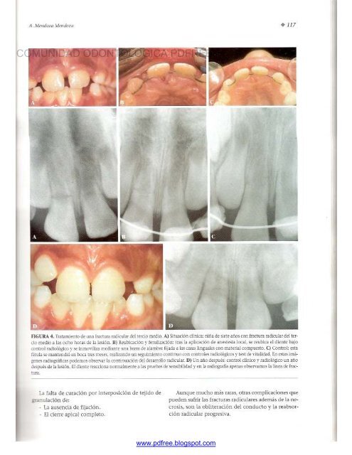 Traumatologia Oral en Odontopediatria: Diagnostico y tratamiento integral