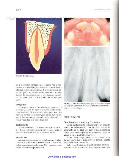 Traumatologia Oral en Odontopediatria: Diagnostico y tratamiento integral