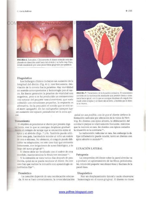 Traumatologia Oral en Odontopediatria: Diagnostico y tratamiento integral