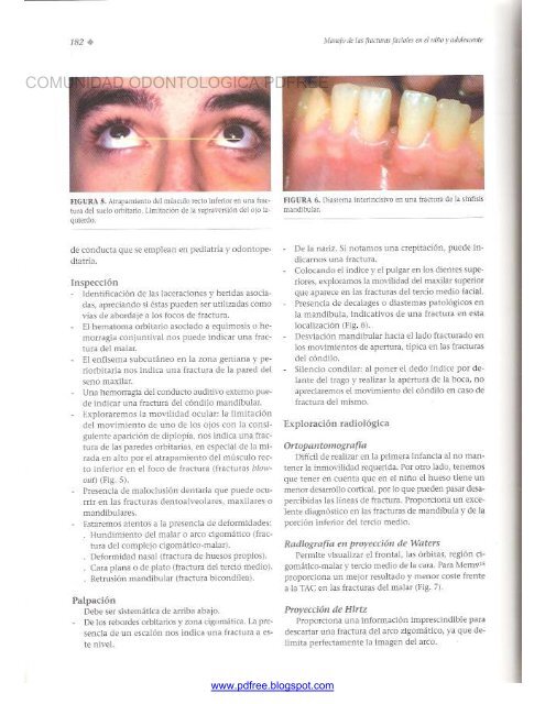 Traumatologia Oral en Odontopediatria: Diagnostico y tratamiento integral