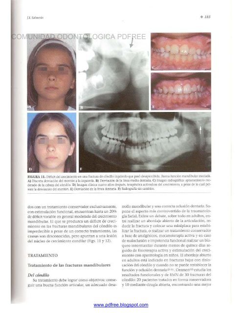 Traumatologia Oral en Odontopediatria: Diagnostico y tratamiento integral