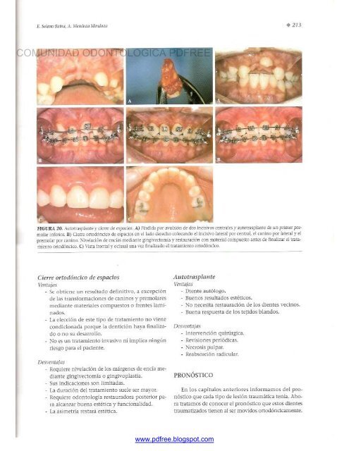 Traumatologia Oral en Odontopediatria: Diagnostico y tratamiento integral