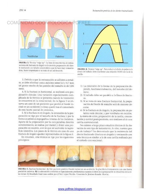 Traumatologia Oral en Odontopediatria: Diagnostico y tratamiento integral