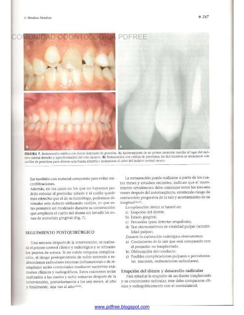 Traumatologia Oral en Odontopediatria: Diagnostico y tratamiento integral