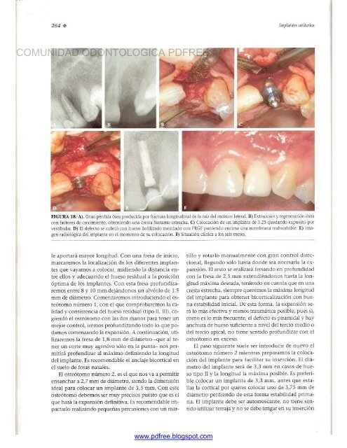 Traumatologia Oral en Odontopediatria: Diagnostico y tratamiento integral