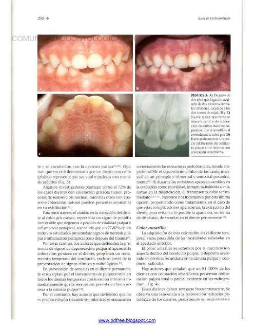 Traumatologia Oral en Odontopediatria: Diagnostico y tratamiento integral