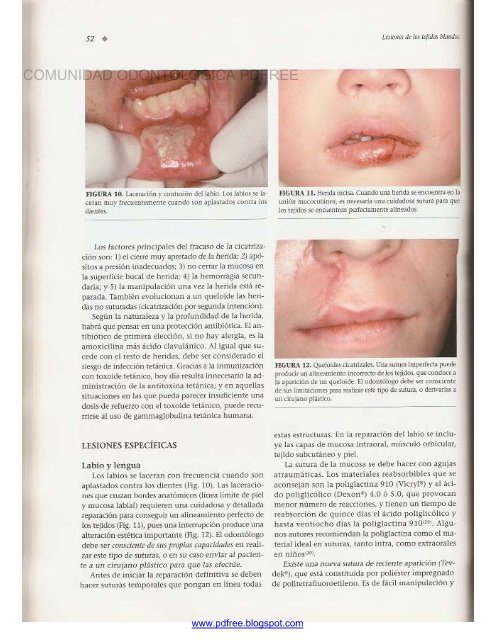 Traumatologia Oral en Odontopediatria: Diagnostico y tratamiento integral