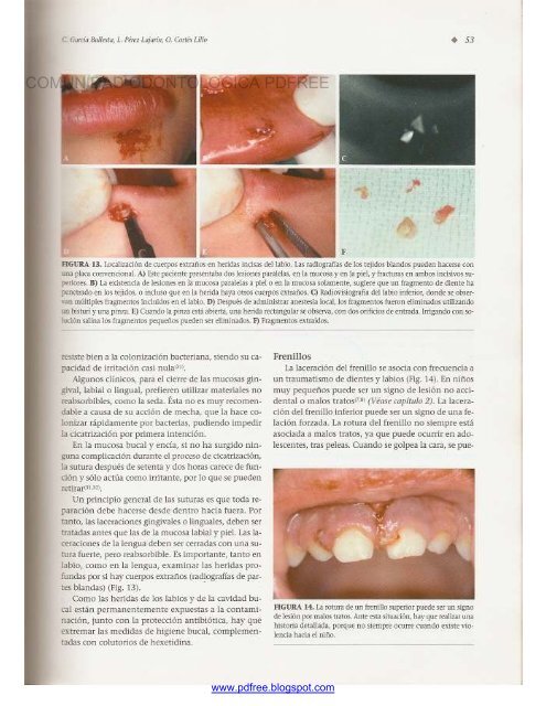 Traumatologia Oral en Odontopediatria: Diagnostico y tratamiento integral