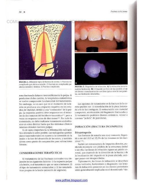 Traumatologia Oral en Odontopediatria: Diagnostico y tratamiento integral