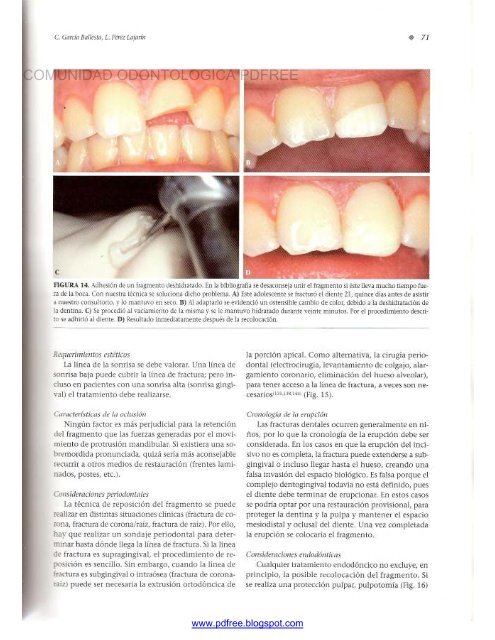 Traumatologia Oral en Odontopediatria: Diagnostico y tratamiento integral