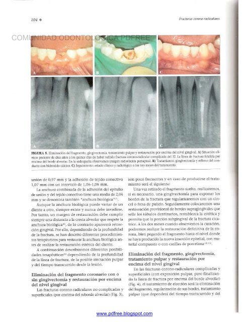 Traumatologia Oral en Odontopediatria: Diagnostico y tratamiento integral