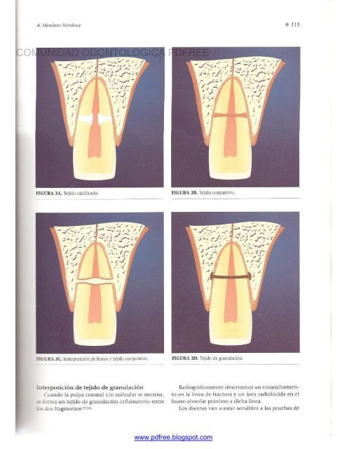 Traumatologia Oral en Odontopediatria: Diagnostico y tratamiento integral