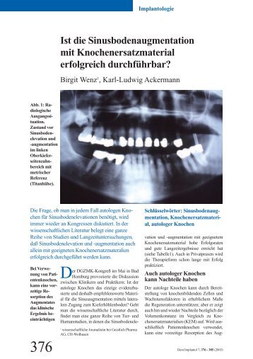 Ist die Sinusbodenaugmentation mit Knochenersatzmaterial ...