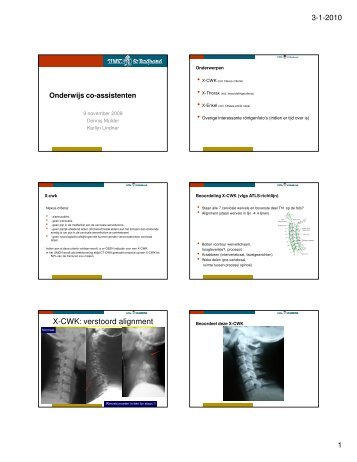 X-CWK: verstoord alignment - Ko-Raad