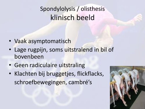 Rugklachten bij turnen