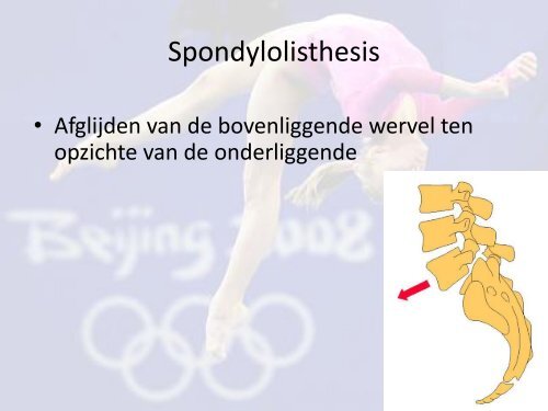 Rugklachten bij turnen