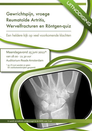 Gewrichtspijn, vroege Reumatoïde Artritis, Wervelfracturen en ...