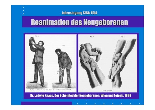 Reanimation des Neugeborenen