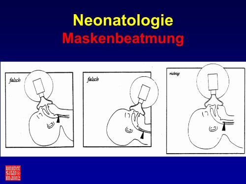 Neugeborenen- primärversorgung - EPLS-Mainz