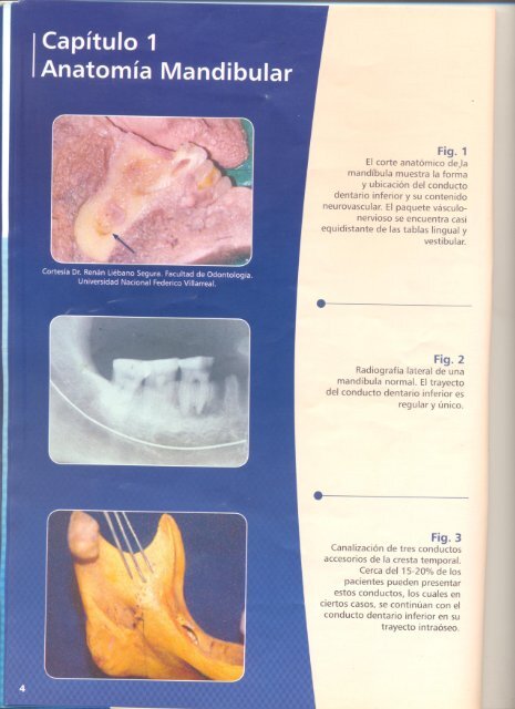 Tecnicas anestesicas en odontologia