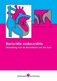 Bacteriële endocarditis - NVVC