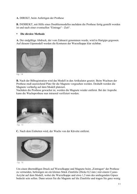 11 A. DIREKT, beim Anfertigen der Prothese B. INDIREKT, mit Hilfe ...